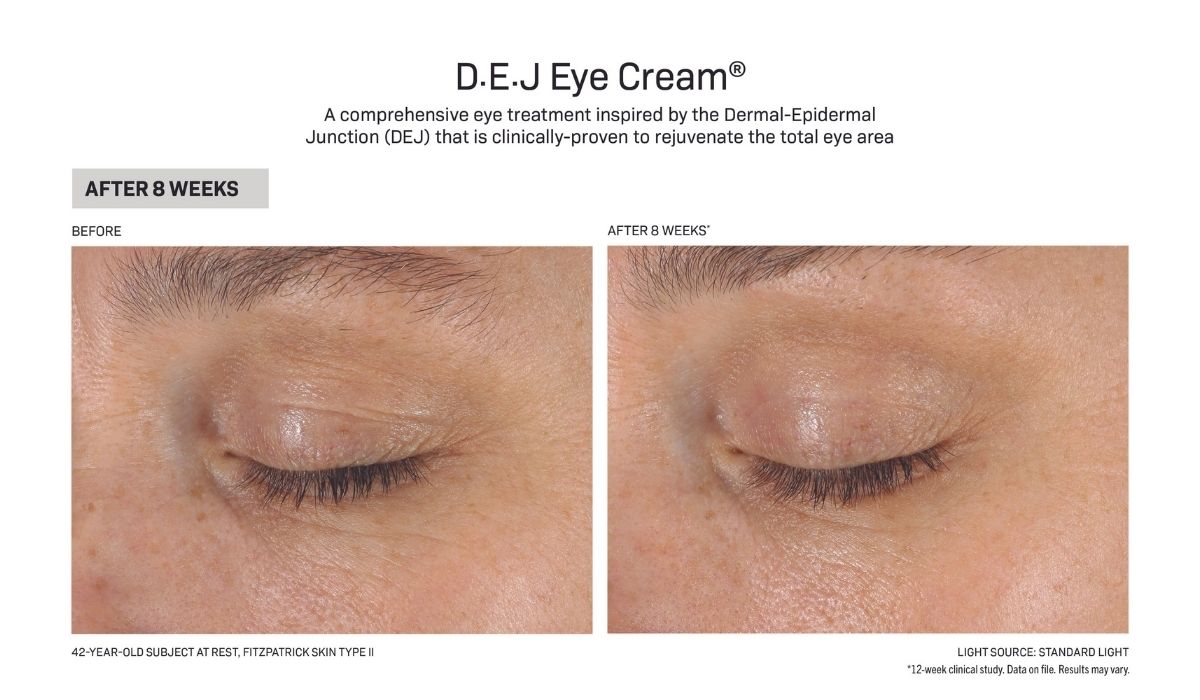 DEJ Eye Before and After image